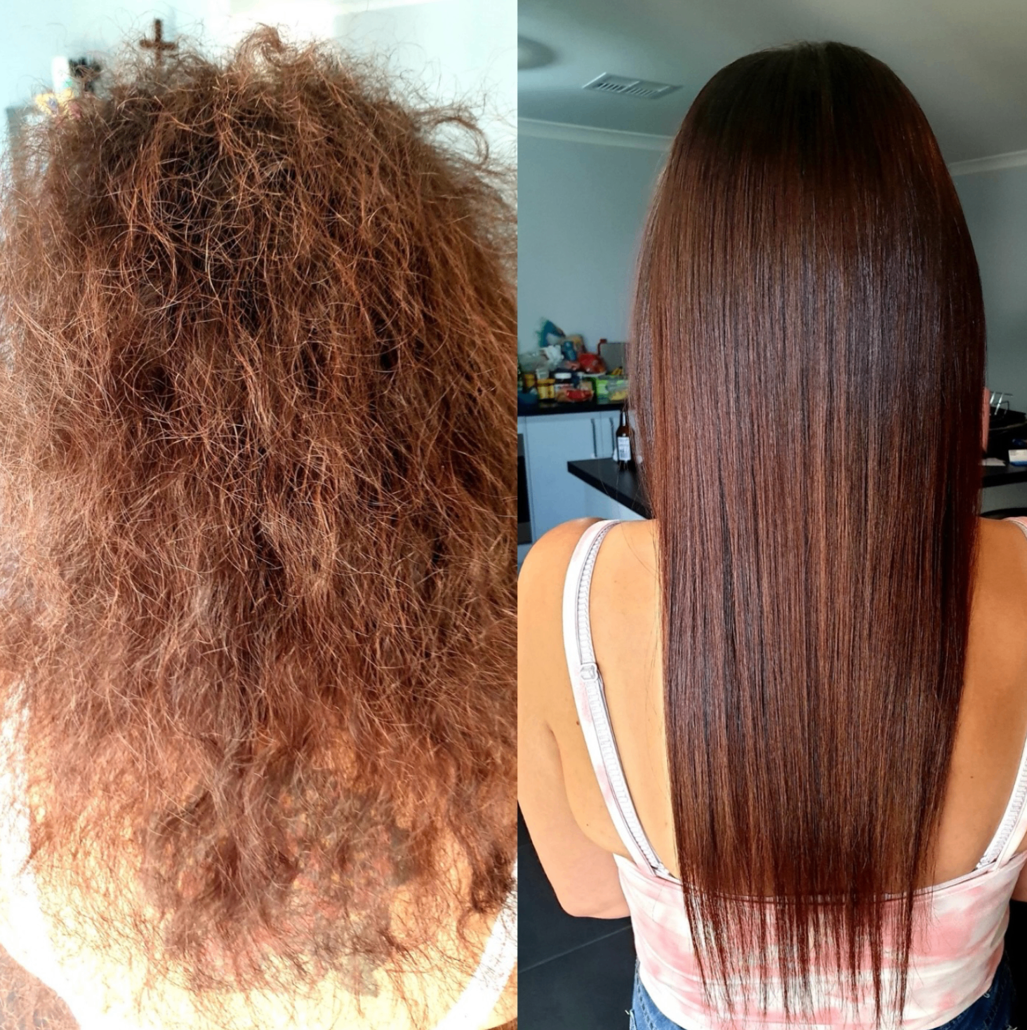 Before and after Keraplasty transformation 1